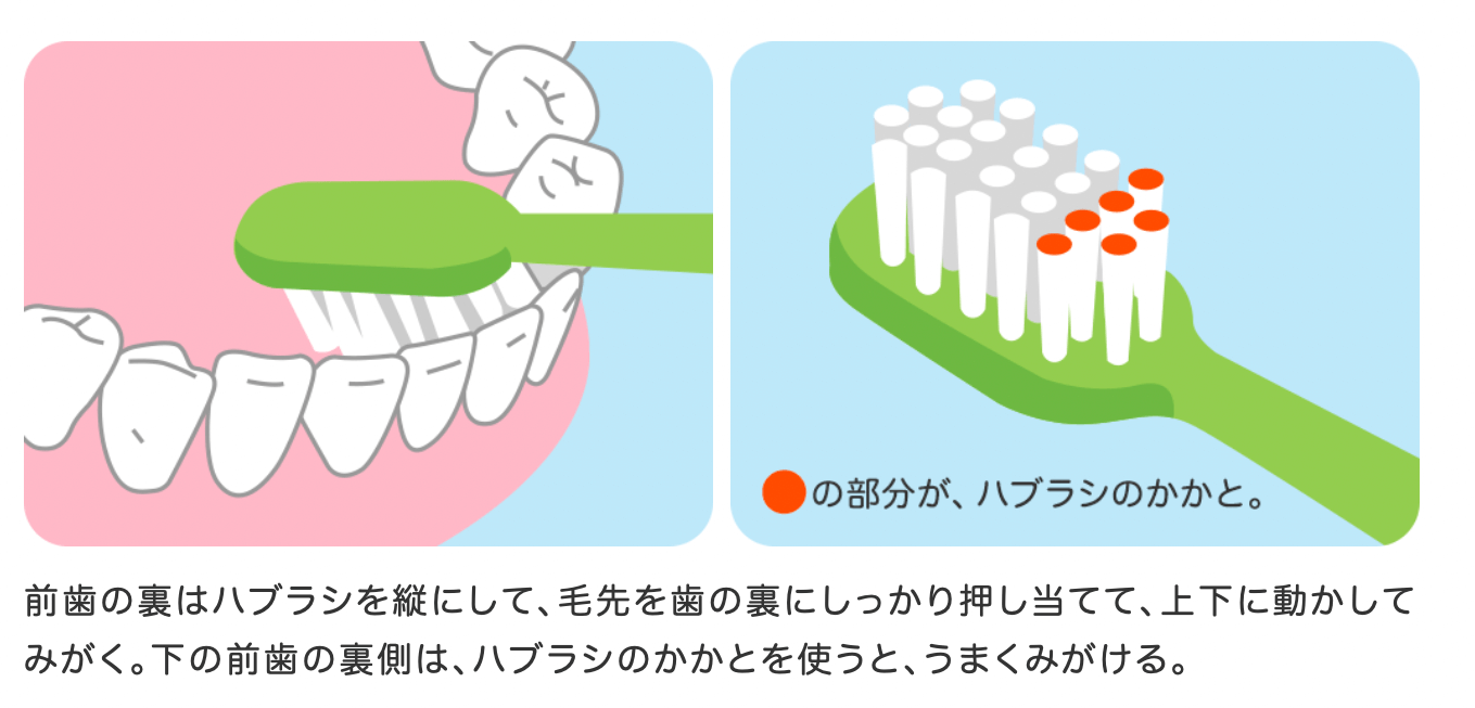 前歯の裏の磨き方